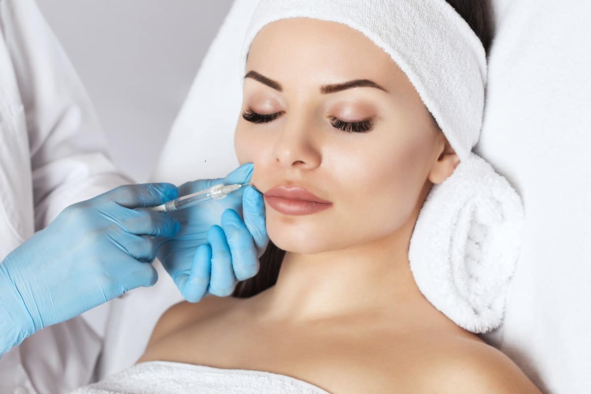 Bellafill dermal filler in Fort Myers