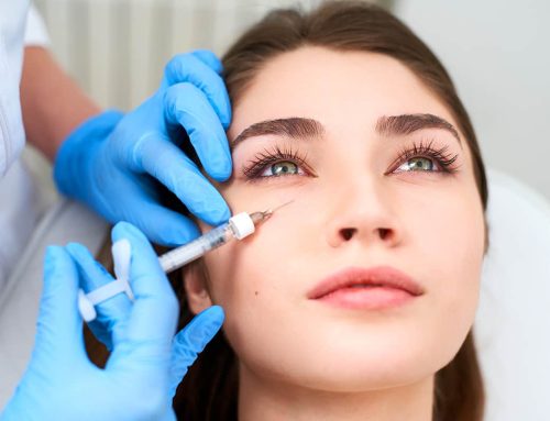 Bellafill vs. Dermal Fillers: Which is Right for You?