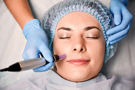 SkinPen Microneedling Fort Myers