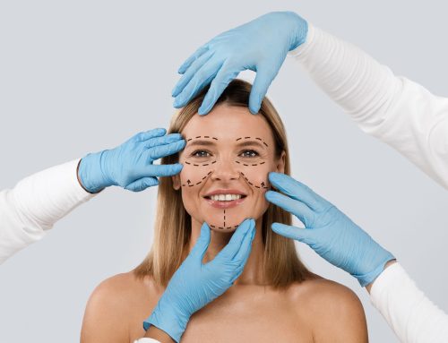 Debunking The Top 10 Myths About Facelifts