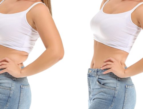 How EvolveX Body Sculpting Can Help Transform Your Shape