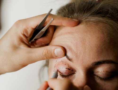 How Long Does Eyelid Surgery Take to Heal?