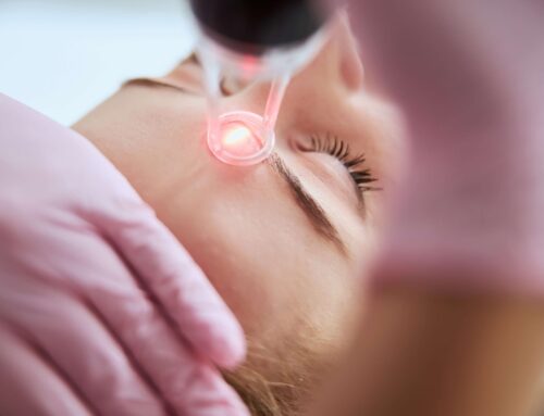 Is CO2 Laser Resurfacing Safe for All Skin Types?